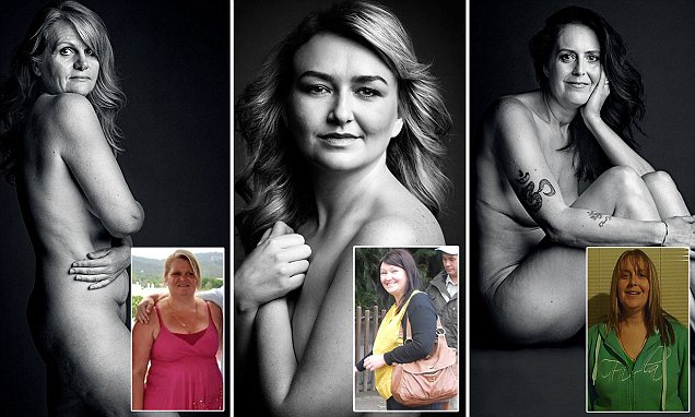 Tiga Wanita Tambun Pamer Aurat pasca Sukses Turunkan Bobot 80 Kg